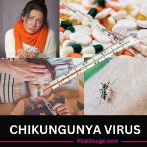 CHIKUNGUNYA IN KARACHI PAKISTAN
