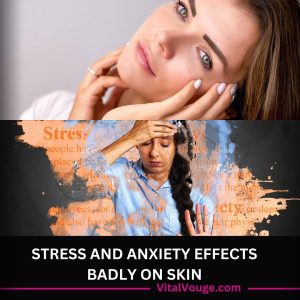 STRESS AND ANXIETY EFFECTS BADLY ON SKIN